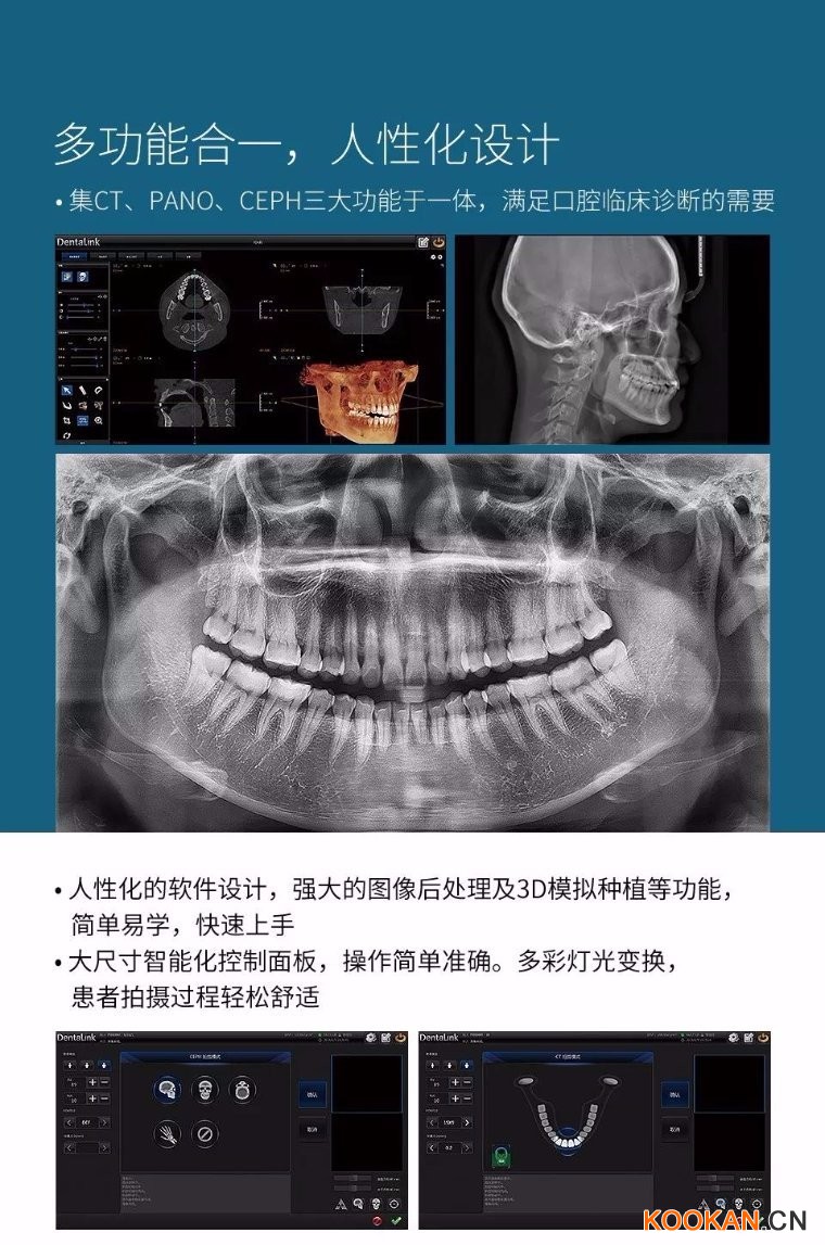 菲森CBCT多功能合一，人性化设计