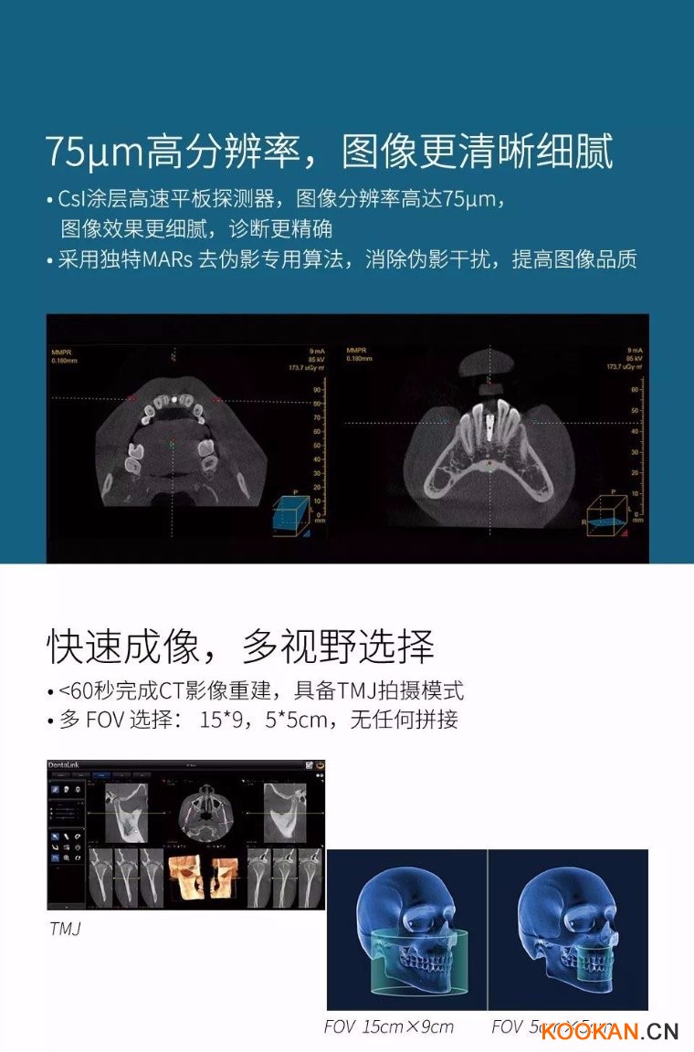 菲森CBCT拍摄影像图像清晰细腻